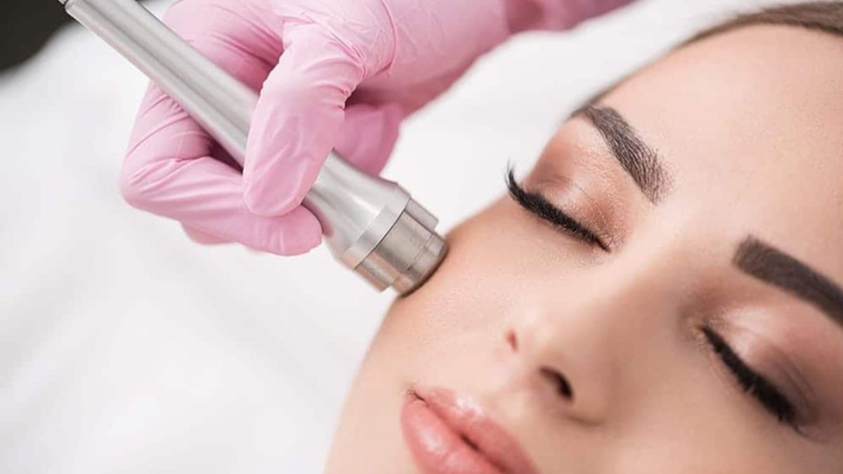 The Benefits and Applications of Microdermabrasion Dermapen for B2B