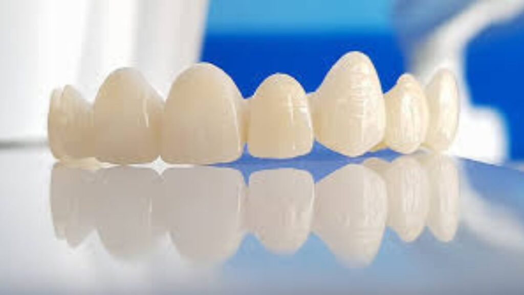 Your Guide to Zirconia Crowns