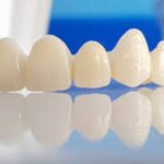 Your Guide to Zirconia Crowns