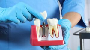 Exploring the Cost of Dental Crowns